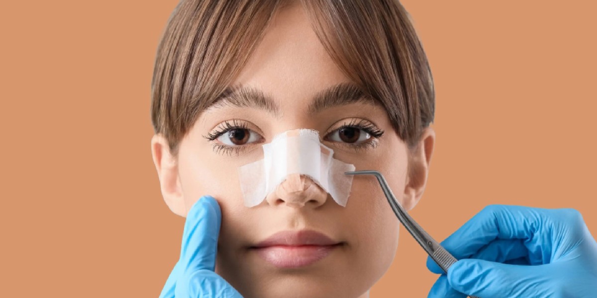 What Are the Potential Benefits of Septoplasty in Dubai Treatment?
